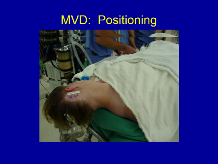 MVD Positioning